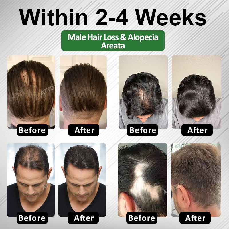 🔥Hot Sellers- ReGain+ Density Renewal Hair Serum