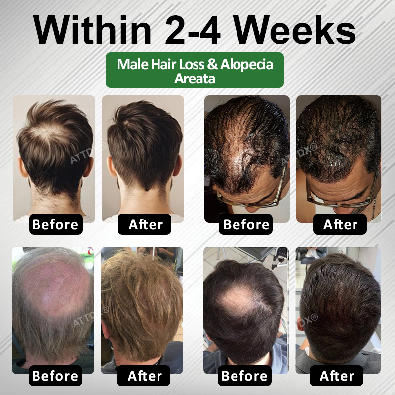 🔥Hot Sellers- ReGain+ Density Renewal Hair Serum