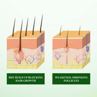 🔥Hot Sellers- ReGain+ Density Renewal Hair Serum