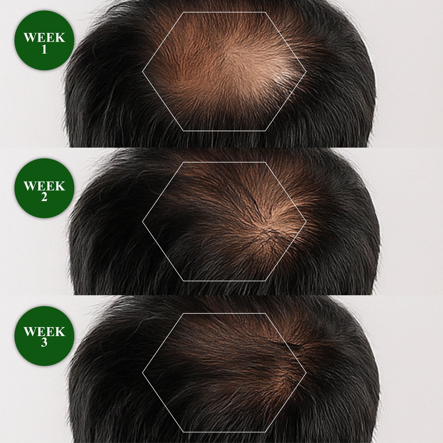 🔥Hot Sellers- ReGain+ Density Renewal Hair Serum