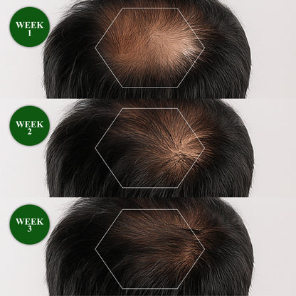 🔥Hot Sellers- ReGain+ Density Renewal Hair Serum