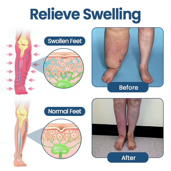 Roll-On Pump Cream for Lymphatic Drainage & Swelling Relief