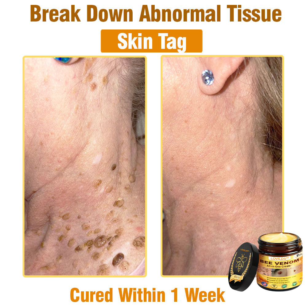 Bee Venom Cream – 🌸 Anti-Aging, Hydrating & Skin Repair