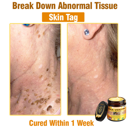 Bee Venom Cream – 🌸 Anti-Aging, Hydrating & Skin Repair