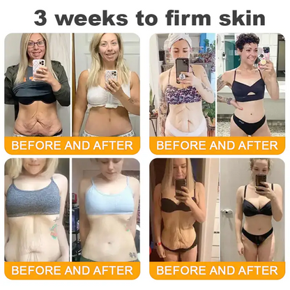 ✨FDA Approved:Bee Venom Skin Restoration Cream