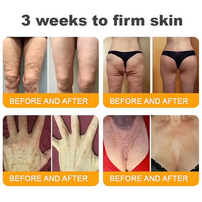 ✨FDA Approved:Bee Venom Skin Restoration Cream