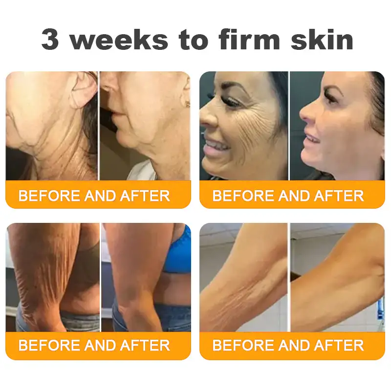 Bee Venom Cream – 🌸 Anti-Aging, Hydrating & Skin Repair