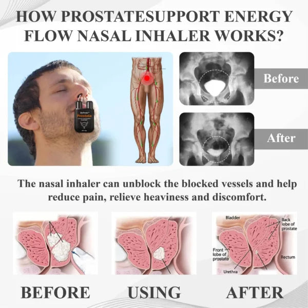 ProstaAir Dual-Function Nasal Inhaler