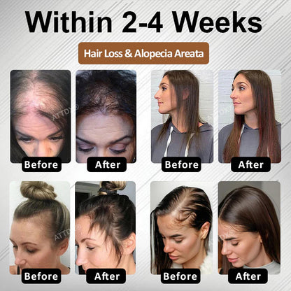 🔥Hot Sellers- ReGain+ Density Renewal Hair Serum