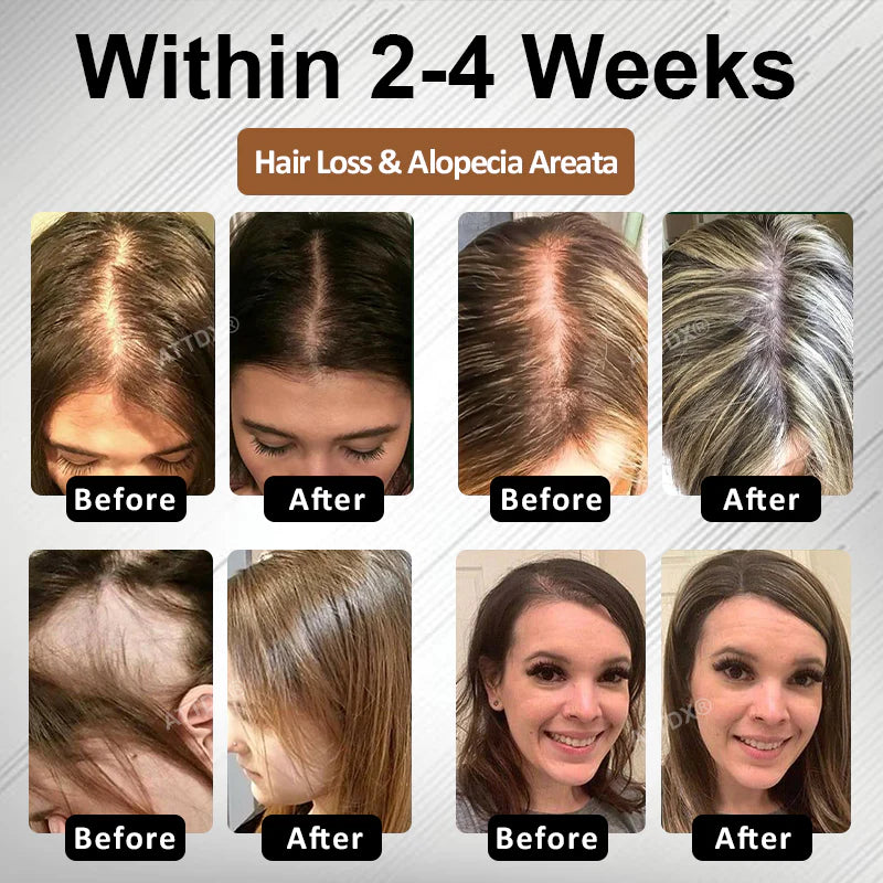 🔥Hot Sellers- ReGain+ Density Renewal Hair Serum