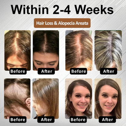 🔥Hot Sellers- ReGain+ Density Renewal Hair Serum