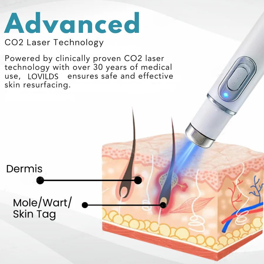 🔥【OFFICIAL STORE】 Non-Invasive Mole and Wart Removal Laser Pen
