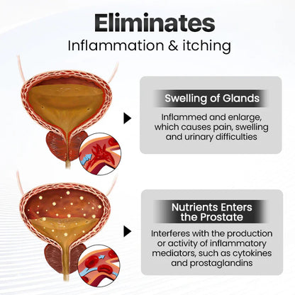 🎅Christmas Sale 🎄BeeBreathe Prostate Care Nasal Therapy Inhaler