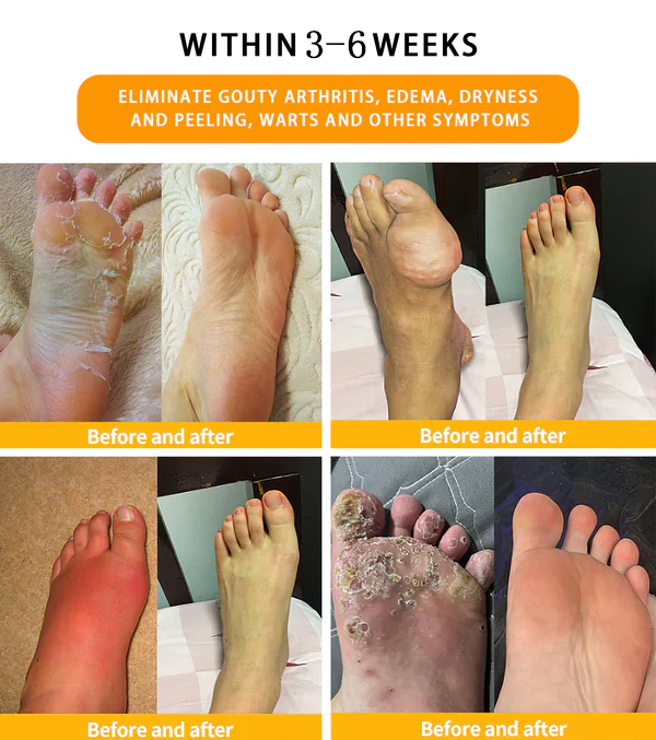 🔥30-Herb Slimming & Detox Foot Bath Beads-🦵👩‍⚕️(LANA Certification, Lymphatic Association of America)